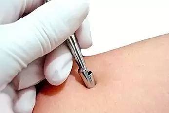 biópsia de pele