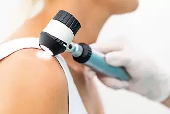 dermatoscopia