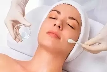 peeling químico